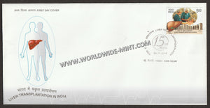 2014 INDIA Liver Transplantation in India FDC